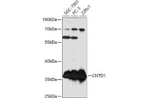 Western blot analysis of extracts of various cell lines, using CNTD1 antibody (ABIN7266574) at 1:1000 dilution. (CNTD1 antibody  (AA 1-120))