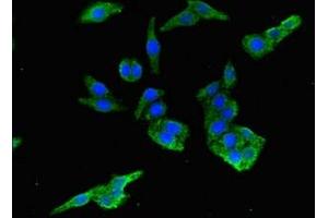 Immunofluorescent analysis of HepG2 cells using ABIN7165984 at dilution of 1:100 and Alexa Fluor 488-congugated AffiniPure Goat Anti-Rabbit IgG(H+L) (PIH1D3 antibody  (AA 1-214))