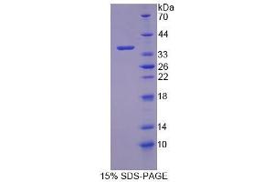 SDS-PAGE (SDS) image for Cyclin-Dependent Kinase 18 (CDK18) (AA 121-402) protein (His tag) (ABIN4990243) (CDK18 Protein (AA 121-402) (His tag))
