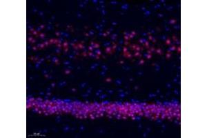 Immunofluorescence of paraffin embedded rat hippocampus using neun (ABIN7075479) at dilution of 1: 500 (200x lens) (NeuN antibody)