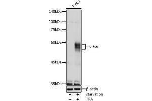 Western blot analysis of extracts of HeLa cells, using c-Fos antibody (ABIN3020747, ABIN3020748, ABIN3020749, ABIN1512925 and ABIN6213704) at 1:1000 dilution. (c-FOS antibody  (AA 211-380))