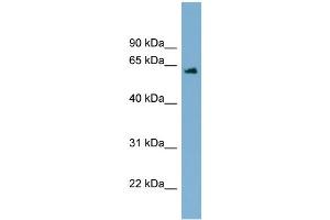 WB Suggested Anti-C12orf4 Antibody Titration: 0. (C12orf4 antibody  (Middle Region))