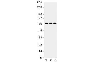 Western blot testing of CD30 antibody and Lane 1:  HeLa (TNFRSF8 antibody  (AA 322-595))