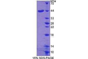 Image no. 1 for serpin Peptidase Inhibitor, Clade E (Nexin, Plasminogen Activator Inhibitor Type 1), Member 2 (SERPINE2) (AA 20-398) protein (His tag) (ABIN4989809) (SERPINE2 Protein (AA 20-398) (His tag))