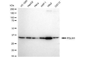Western blotting analysis using PDLIM1 antibody (ABIN7799748).