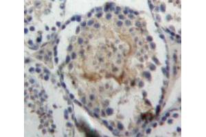 Used in DAB staining on fromalin fixed paraffin-embedded Testis tissue (VWA1 antibody  (AA 135-366))
