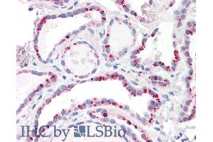 ABIN184646 (10µg/ml) staining of paraffin embedded Human Thyroid. (PPP2CB antibody  (C-Term))