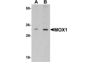 Western blot analysis of MOX1 in human liver tissue lysate with MOX1 antibody at (A) 1 and (B) 2 μg/ml. (MEOX1 antibody  (Center))
