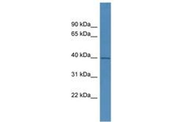 PHYHIPL antibody  (C-Term)