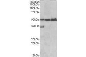 Antibody (0. (LSP1 antibody  (C-Term))