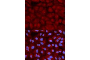 Immunofluorescence (IF) image for anti-Bridging Integrator 1 (BIN1) antibody (ABIN1871291) (BIN1 antibody)