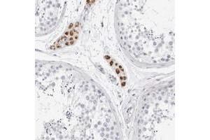 Immunohistochemical staining of human testis with GBP6 polyclonal antibody  shows strong cytoplasmic positivity in Leydig cells. (GBP6 antibody)