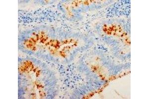 Image no. 1 for anti-Cyclin-Dependent Kinase Inhibitor 1B (p27, Kip1) (CDKN1B) (C-Term) antibody (ABIN1492939)
