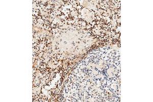 Immunohistochemistry (Paraffin-embedded Sections) (IHC (p)) image for anti-Signal Transducer and Activator of Transcription 1, 91kDa (STAT1) (AA 717-745), (C-Term) antibody (ABIN1881847)