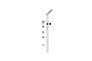Anti-IGSF8 Antibody (Center) at 1:1000 dilution + human brain lysate Lysates/proteins at 20 μg per lane.