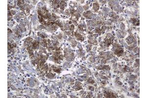 Image no. 2 for anti-Mast/stem Cell Growth Factor Receptor (KIT) (AA 546-976) antibody (ABIN1491585) (KIT antibody  (AA 546-976))