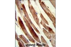 Formalin-fixed and paraffin-embedded human skeletal muscle reacted with TAGLN Antibody (N-term), which was peroxidase-conjugated to the secondary antibody, followed by DAB staining. (Transgelin antibody  (N-Term))
