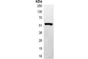 Immunoprecipitation of His-tagged protein from HEK293T cells transfected with vector overexpressing His tag, using Anti-His-tag Antibody. (His Tag antibody)