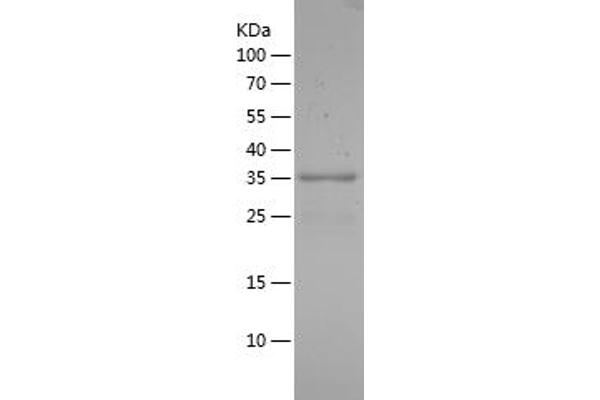 FOXO1 Protein (AA 353-655) (His tag)