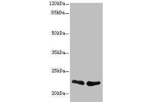 Western blot All lanes: TNFAIP8 antibody at 2. (TNFAIP8 antibody  (AA 1-198))