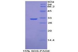 SDS-PAGE (SDS) image for phosphoenolpyruvate Carboxykinase 1 (Soluble) (PCK1) (AA 312-563) protein (His tag) (ABIN2126277)