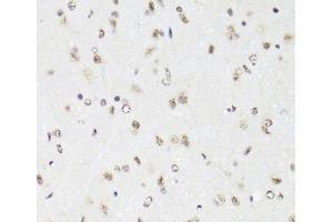 Immunohistochemistry (Paraffin-embedded Sections) (IHC (p)) image for anti-Elongation Factor Tu GTP Binding Domain Containing 2 (EFTUD2) antibody (ABIN7262991)