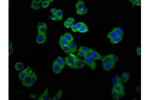 Immunofluorescence staining of PC-3 cells with ABIN7153683 at 1:100, counter-stained with DAPI. (GRPR antibody  (AA 326-384))