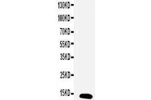Anti-Estrogen Inducible Protein Ps2 antibody, Western blotting WB: MCF-7 Cell Lysate (TFF1 antibody  (Middle Region))