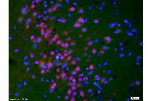Formalin-fixed and paraffin-embedded rat brain labeled with Anti-Phospho-HER3 (Tyr1289) Polyclonal Antibody, Unconjugated (ABIN747113) 1:200, overnight at 4°C, The secondary antibody was Goat Anti-Rabbit IgG, Cy3 conjugated used at 1:200 dilution for 40 minutes at 37°C. (ERBB3 antibody  (pTyr1289))