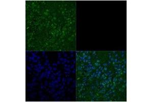 Primary metastatic Melenoma (TBX3 antibody  (Middle Region))