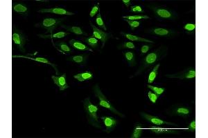 Immunofluorescence of purified MaxPab antibody to ALOX5 on HeLa cell. (ALOX5 antibody  (AA 1-674))