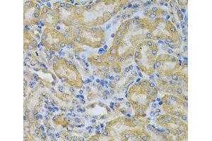 Immunohistochemistry of paraffin-embedded Mouse kidney using PGK1 Polyclonal Antibody at dilution of 1:100 (40x lens). (PGK1 antibody)