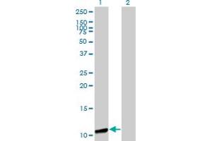 Western Blot analysis of GTF2A2 expression in transfected 293T cell line by GTF2A2 monoclonal antibody (M01), clone 2B9. (GTF2A2 antibody  (AA 1-109))