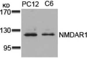 Image no. 1 for anti-NMDA Receptor 1 (NMDA R1) (AA 894-898) antibody (ABIN319312) (NMDA 1 Receptor antibody  (AA 894-898))