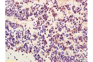 Formalin-fixed and paraffin embedded mouse embryo labeled with Anti-Phospho-TNK1(Tyr277) Polyclonal Antibody, Unconjugated (ABIN746513) at 1:200 followed by conjugation to the secondary antibody and DAB staining (TNK1 antibody  (pTyr277))