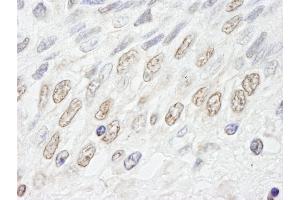 anti-Nucleoporin 50kDa (NUP50) (AA 418-468) antibody