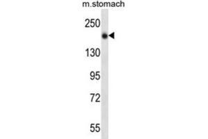 Western Blotting (WB) image for anti-Unc-13 Homolog B (UNC13B) antibody (ABIN2997152)
