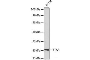 Western blot analysis of extracts of various cell lines using STAR Polyclonal Antibody at dilution of 1:1000. (STAR antibody)