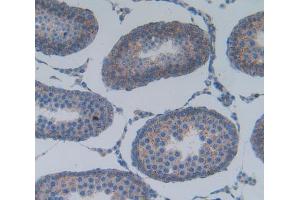 Used in DAB staining on fromalin fixed paraffin- embedded testis tissue (PLA2G2A antibody  (AA 22-146))