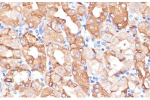 Immunohistochemistry of paraffin-embedded Human stomach using NHLRC1 Polyclonal Antibody at dilution of 1:100 (40x lens). (NHLRC1 antibody)