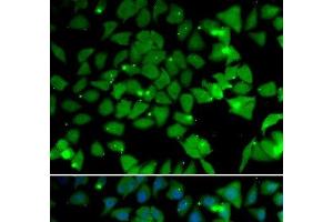 Immunofluorescence analysis of U2OS cells using NAA10 Polyclonal Antibody (NAA10 antibody)