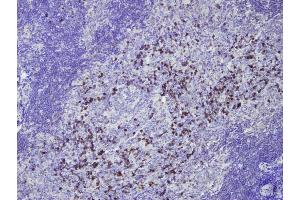Immunohistochemistry (IHC) image for Rabbit anti-Human IgG (AA 167-185), (Internal Region) antibody (ABIN7598854) (Rabbit anti-Human IgG (AA 167-185), (Internal Region) Antibody)