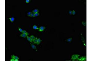 Immunofluorescence (IF) image for anti-Aldolase C, Fructose-Bisphosphate (ALDOC) (AA 190-354) antibody (ABIN7153215)