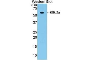 Detection of Recombinant MUC1, Rat using Polyclonal Antibody to Mucin 1 (MUC1) (MUC1 antibody  (AA 404-655))