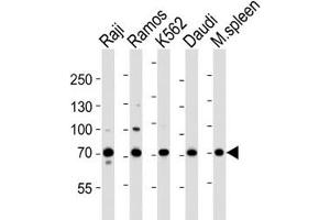 Western blot analysis of lysate from Raji, Ramos, K562, Daudi cell line and mouse spleen tissue lysate using BTK antibody at 1:1000. (BTK antibody  (AA 396-430))