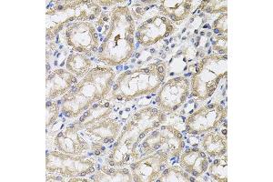 Immunohistochemistry of paraffin-embedded rat kidney using RNF166 antibody. (RNF166 antibody)