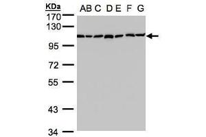 WB Image Sample(30 ug whole cell lysate) A: 293T B: A431 , C: H1299 D: HeLa S3 , E: Hep G2 , F: MOLT4 , G: Raji , 7. (GANAB antibody  (N-Term))