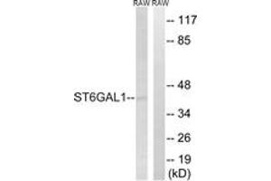 Western blot analysis of extracts from RAW264. (ST6GAL1 antibody  (AA 171-220))