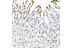 Immunohistochemistry of paraffin-embedded mouse stomach using YTHDF3 antibody at dilution of 1:100 (x40 lens).