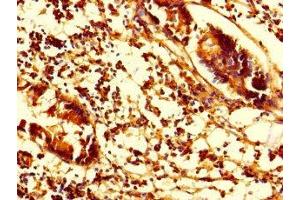 Immunohistochemistry of paraffin-embedded human appendix tissue using ABIN7170841 at dilution of 1:100 (SMAP1 antibody  (AA 1-280))